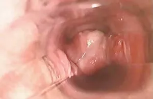 XXX Nóng preggo cô gái fucked qua cô ấy video xxx thu dam trẻ người bạn